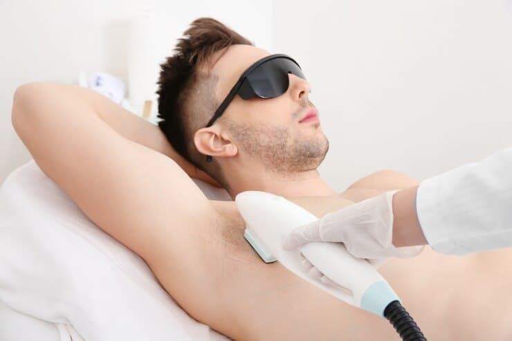 Cover Epilare definitiva barbati axile