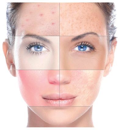 Cover Tratament facial microneedling exozomi