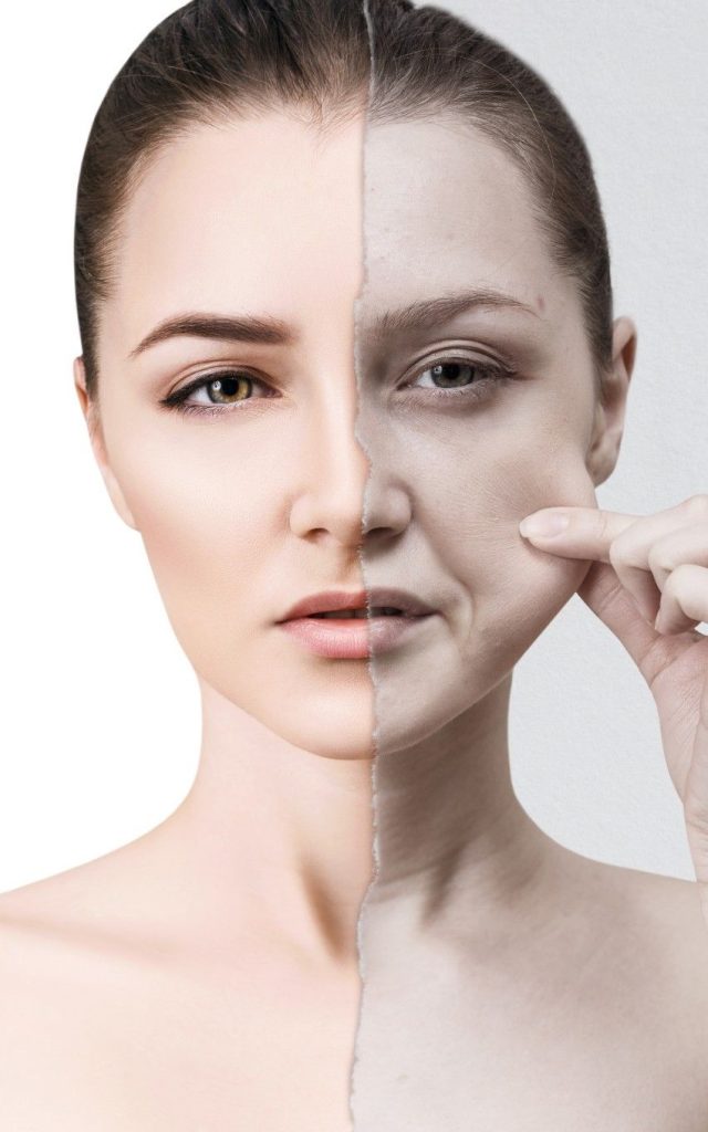 Cover Pachet Promo Lifting facial prin radiofrecventa VPlatinium